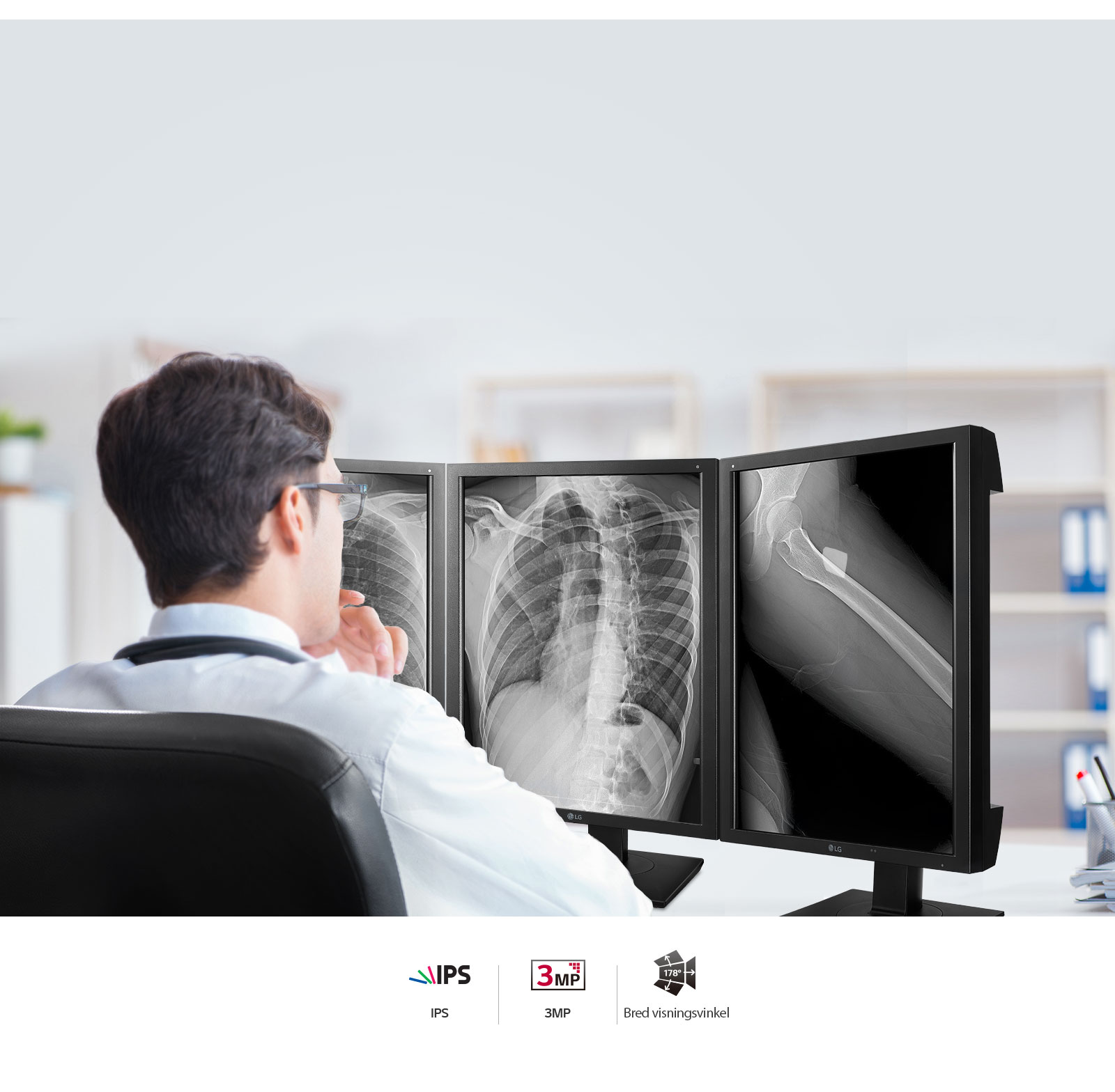 Nøyaktig bildekvalitet1