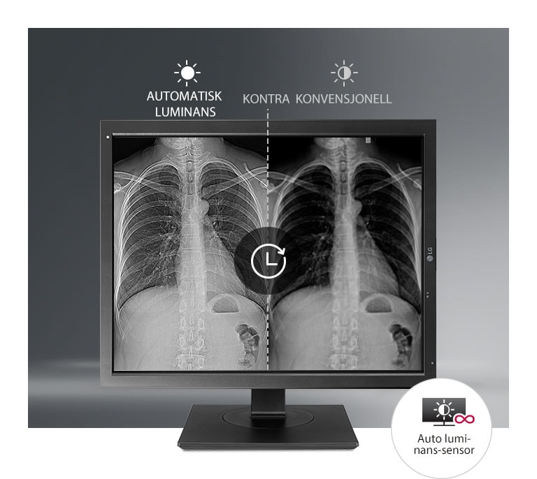 Automatisk stabilisering av lysstyrke2