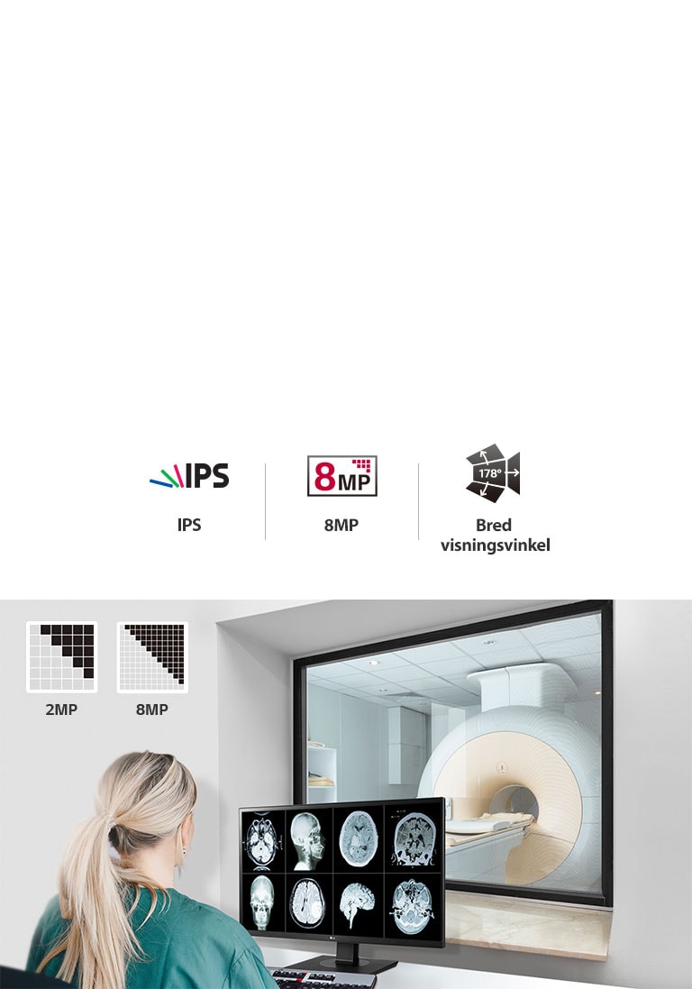 Overlegen bildekvalitet2