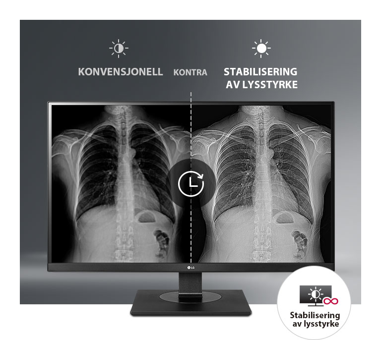 Konsekvent stabil skjerm2