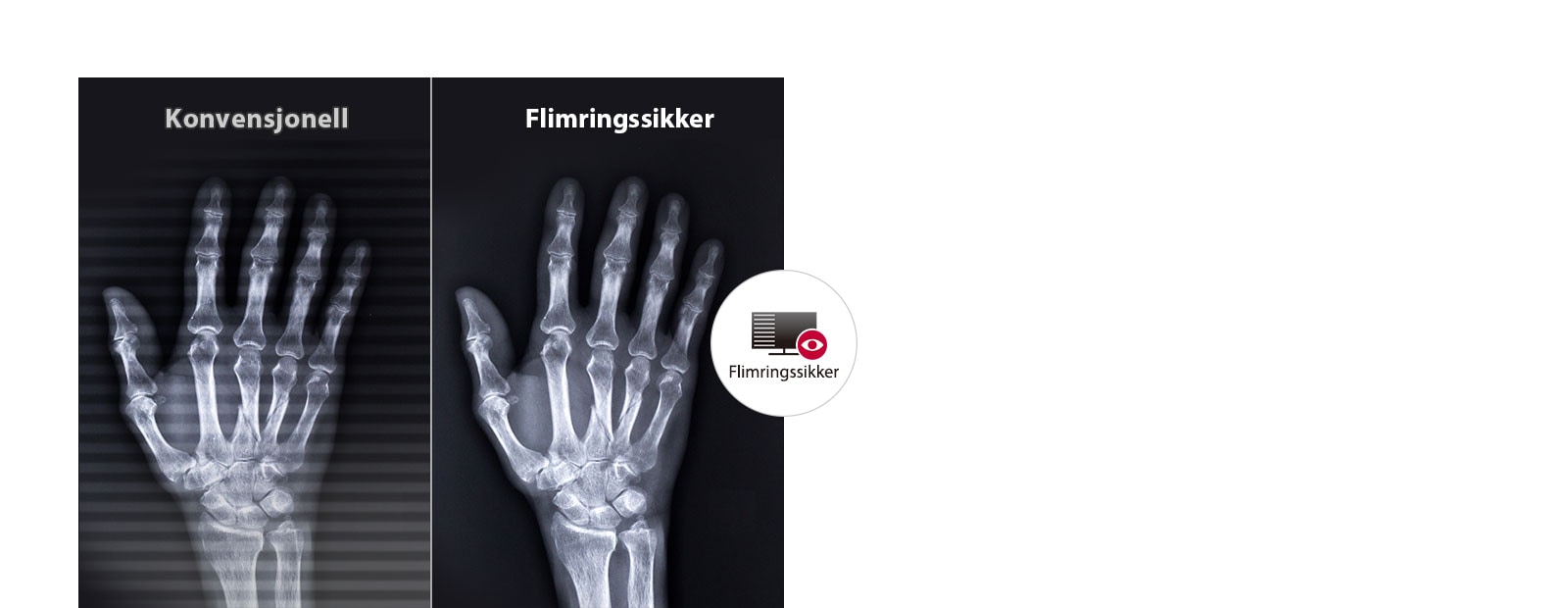 Langvarig komfort for øynene1