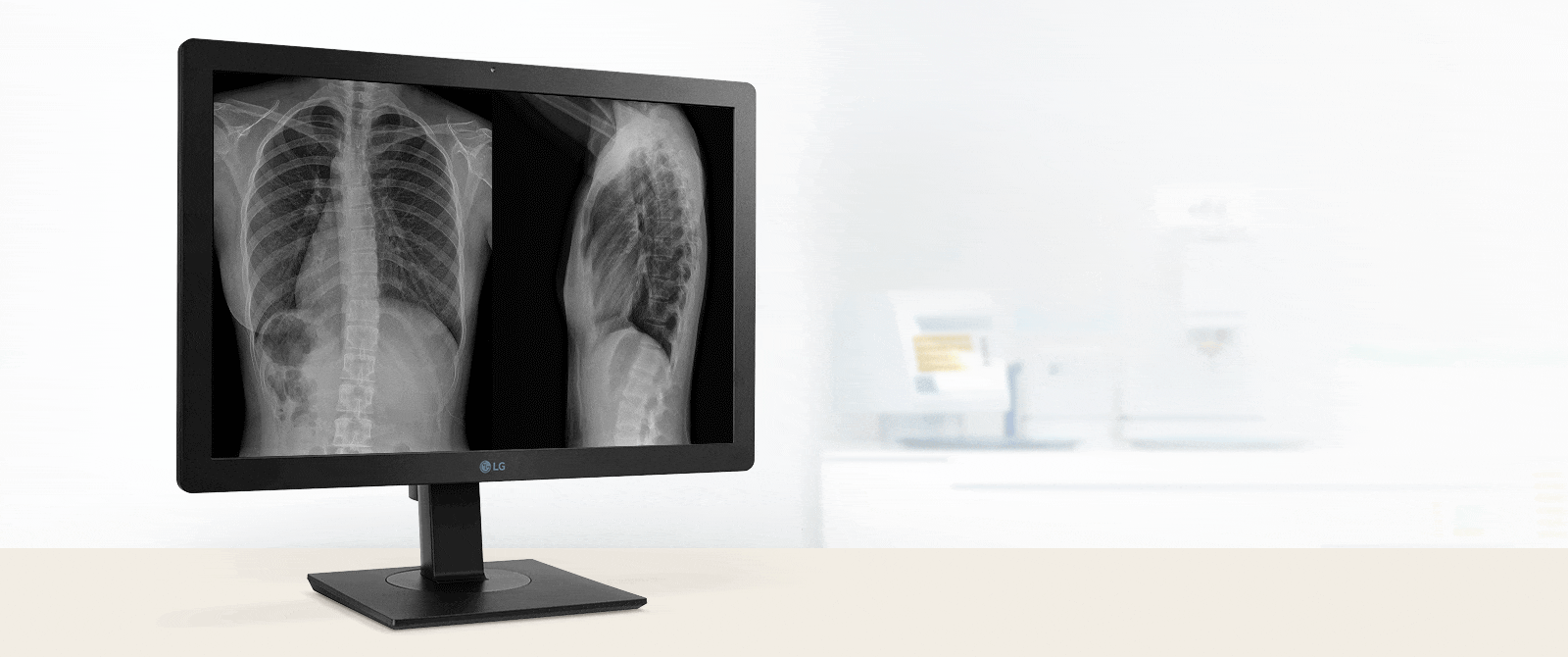 Med høy lysstyrke på 600 cd/m² er denne kliniske gjennomgangsskjermen også egnet for diagnostiske formål.