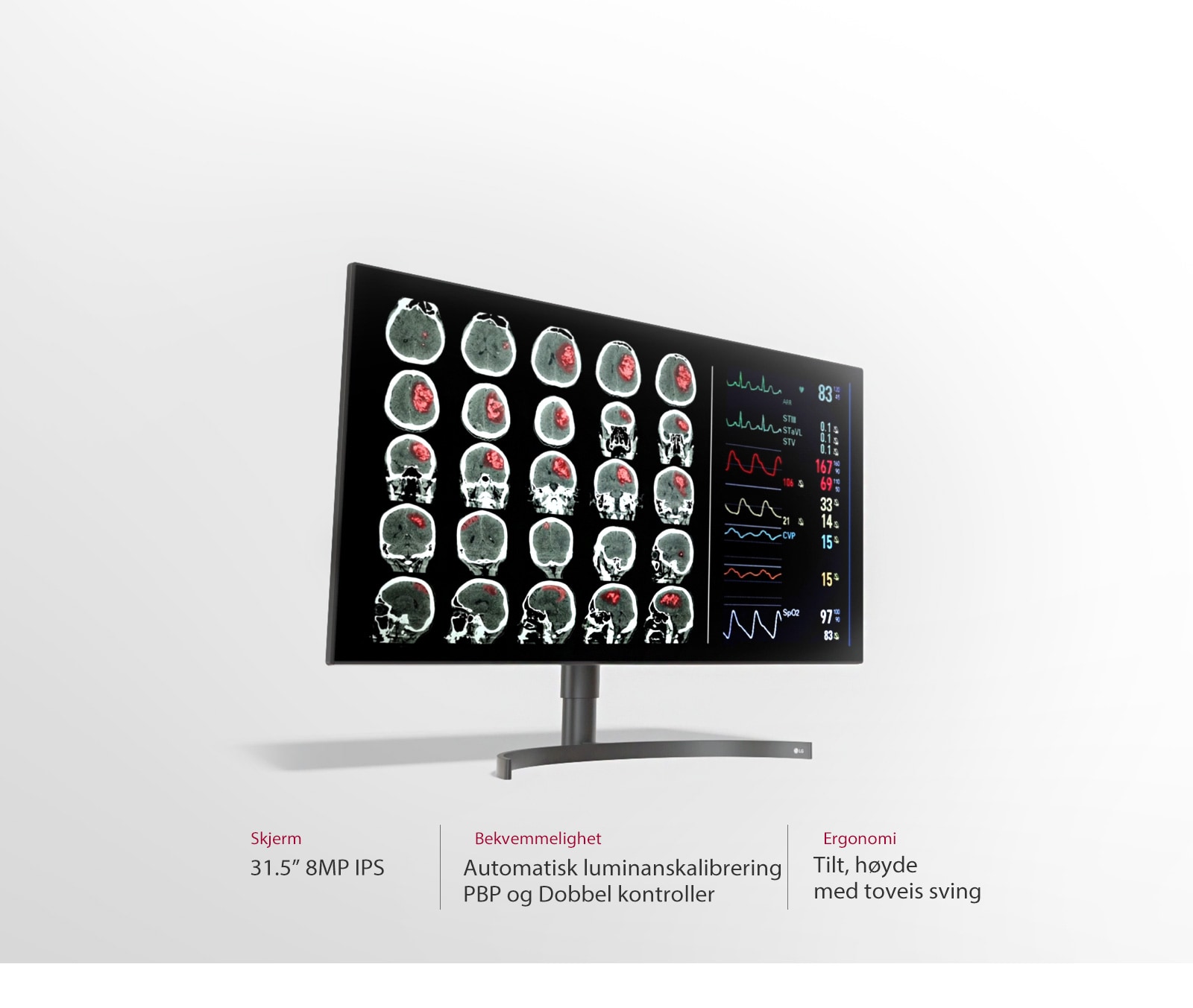 31,5" 8 MP Diagnostisk monitor3