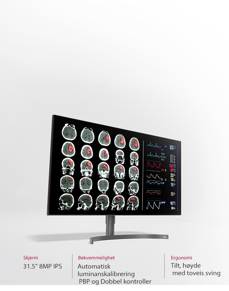 31,5" 8 MP Diagnostisk monitor3