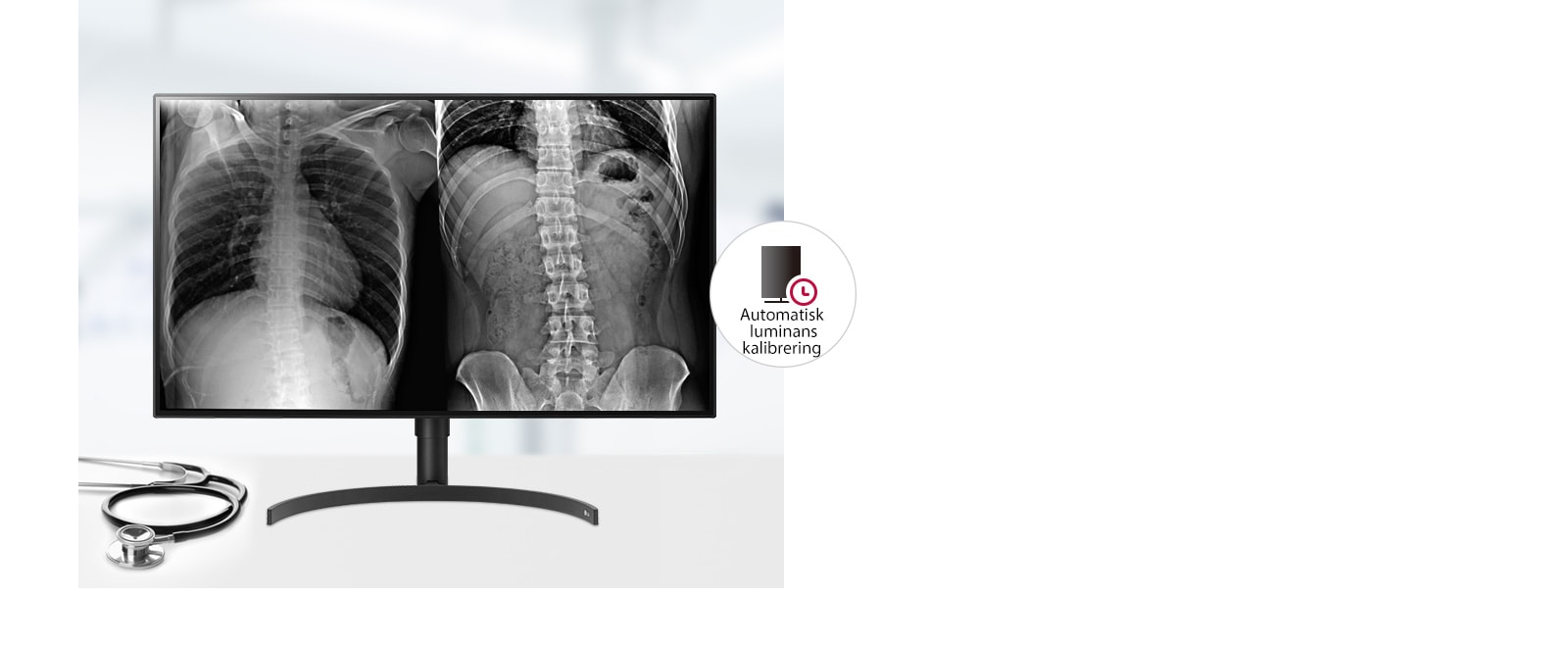 Konsekvent bildekvalitet1