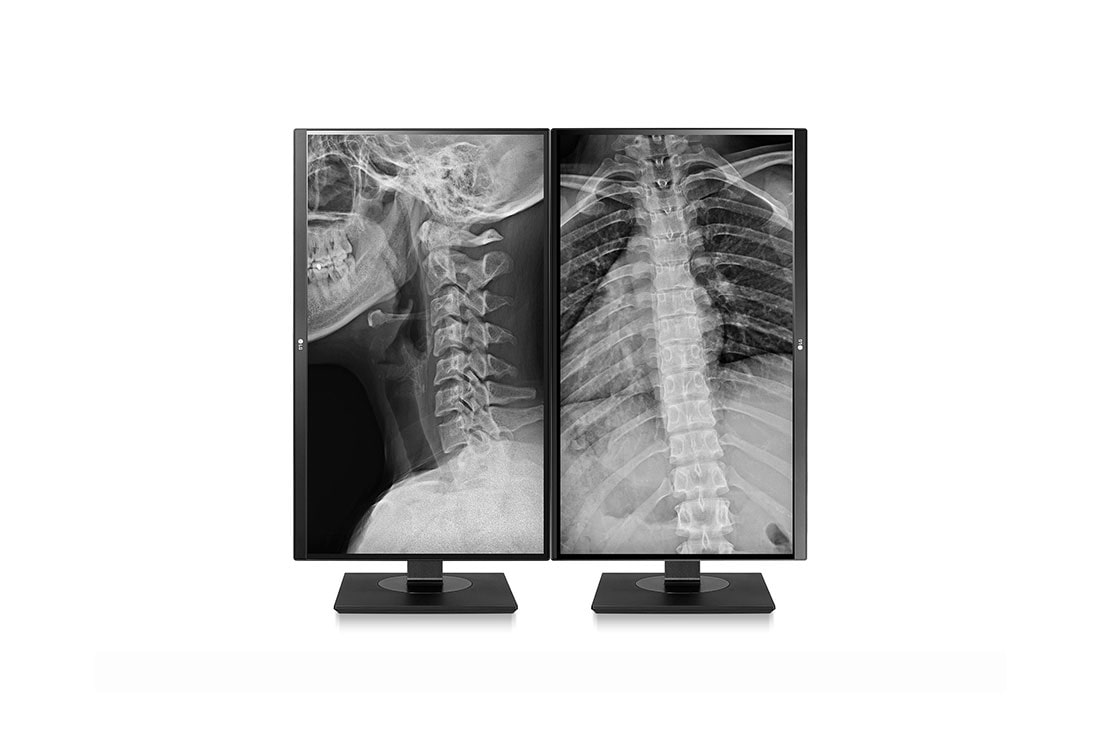 LG 27'' LG 8MP Klinisk undersøkelsesskjerm, 27HJ713C-B, thumbnail 10