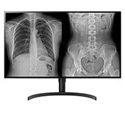 LG 31,5'' LG 8 MP Diagnostisk monitor, 32HL512D-B, thumbnail 1