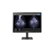 LG 31-tommer 12 MP Diagnostisk monitor for mammografi, 31HN713D-B, thumbnail 2