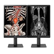 LG 21.3'' 3MP IPS Diagnostisk Monitor, visning forfra med 2 skjermer side om side, 21HQ513D-S, thumbnail 11