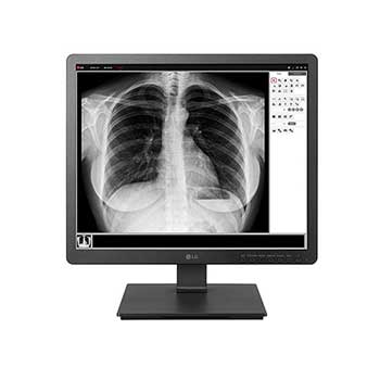 Medyczny monitor przeglądowy LG 19" 1280x1024 19HK312C-B1