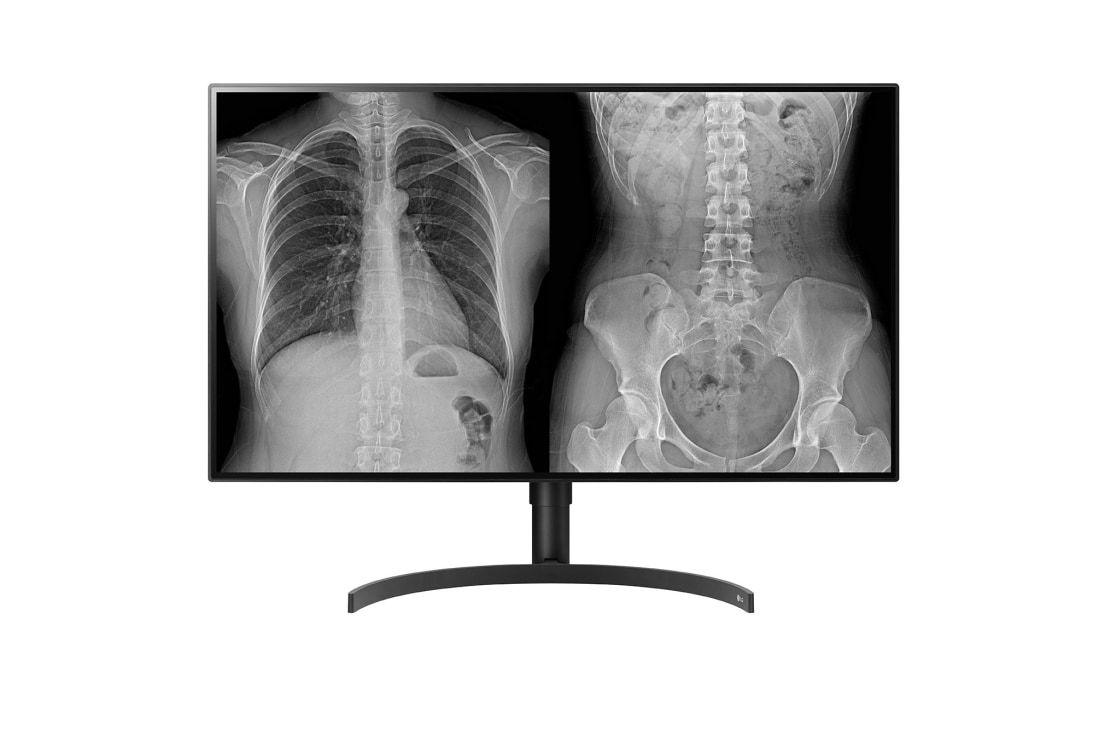 LG 31.5'' Diagnostyczny Monitor Medyczny LG 4K Nano IPS z trybami wielu rozdzielczości (6/4MP) i analizy patologicznej, automatyczna regulacja jasności., 32HL512D-B