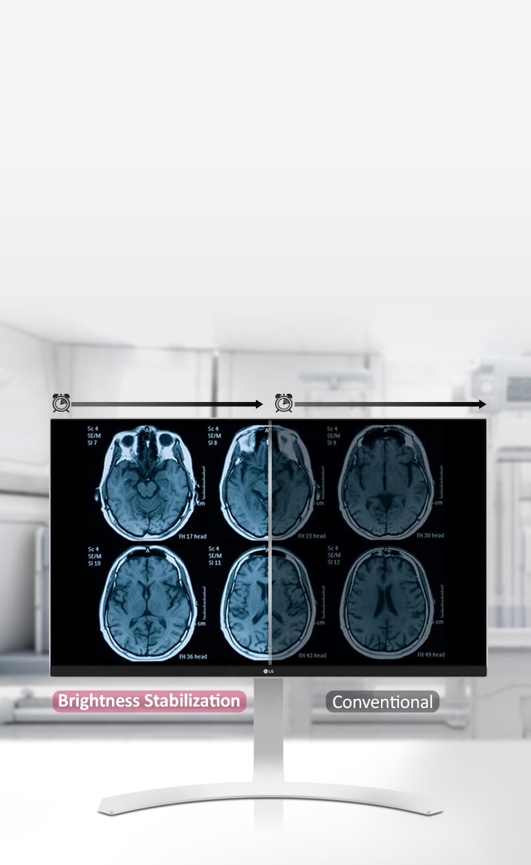Stabilizarea luminozității2