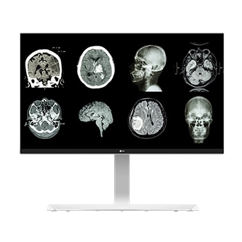 Monitor LG 27" | Ecran IPS de 8MP | 350 de niți cu sRGB peste 99% | Stabilizarea luminozității | Flicker Safe1