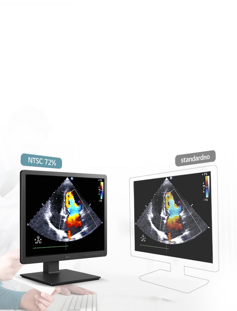 330 nita i NTSC 72%, precizna reolucija2