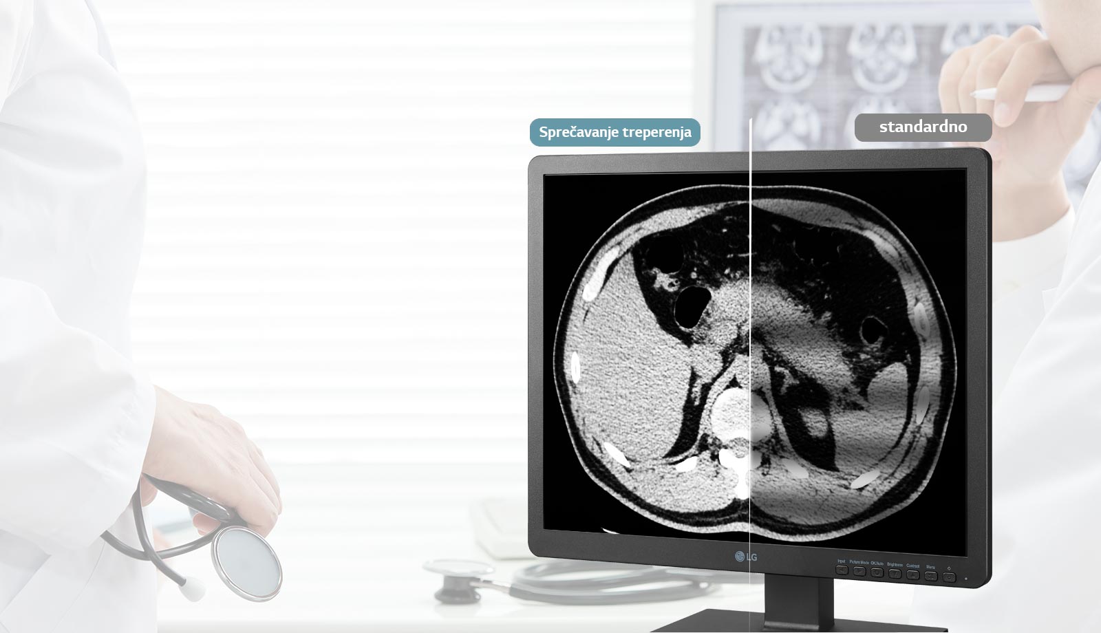 Sprečavanje treperenja1