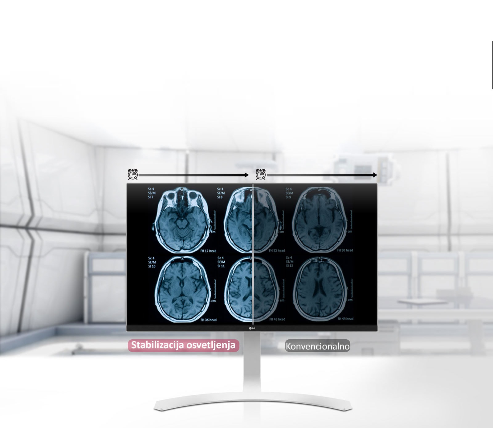 Stabilizacija osvetljenja1