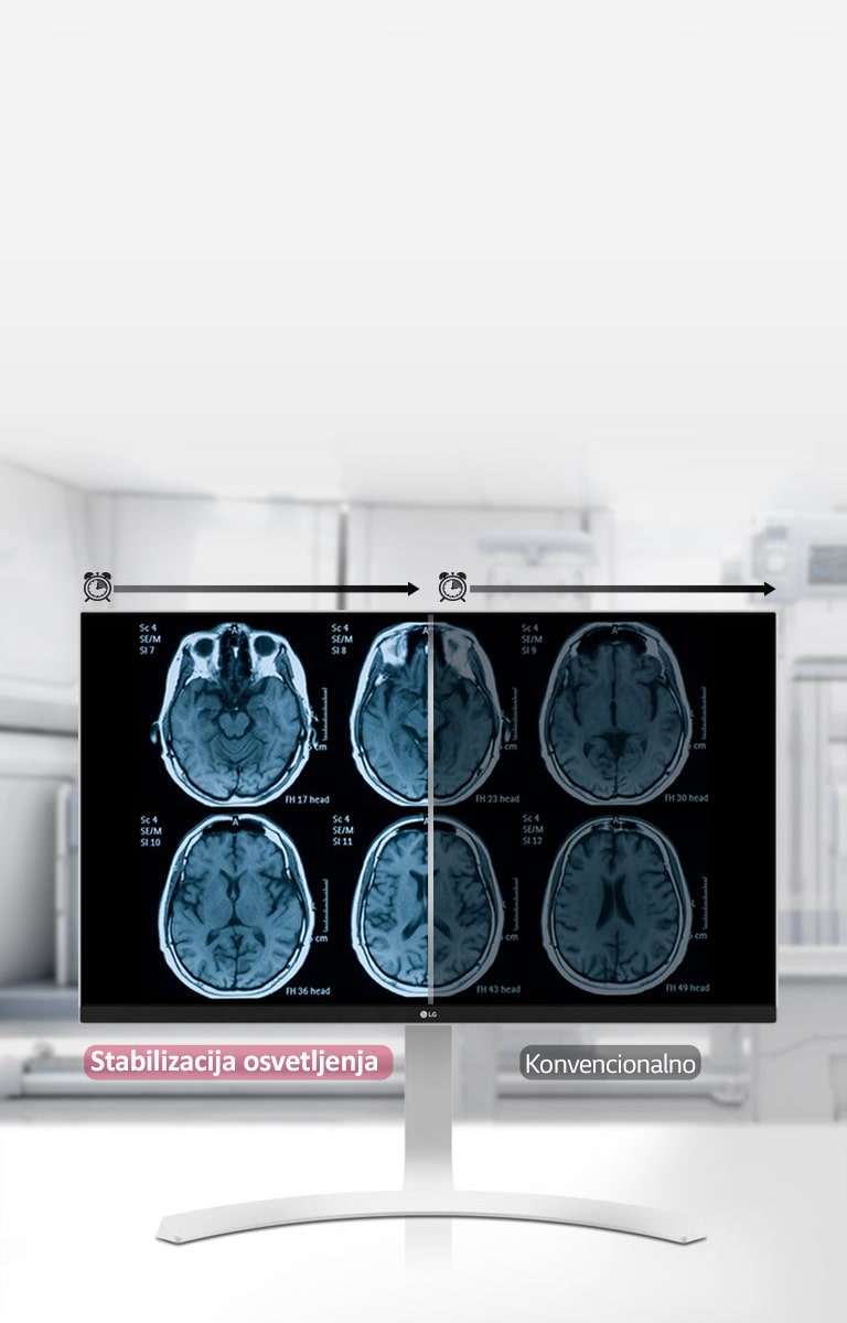 Stabilizacija osvetljenja2
