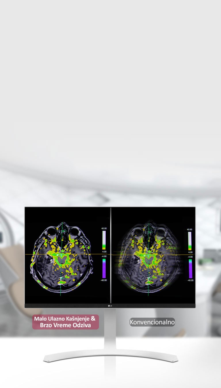 Režim dinamičke sinhronizacije i brzo vreme odziva2