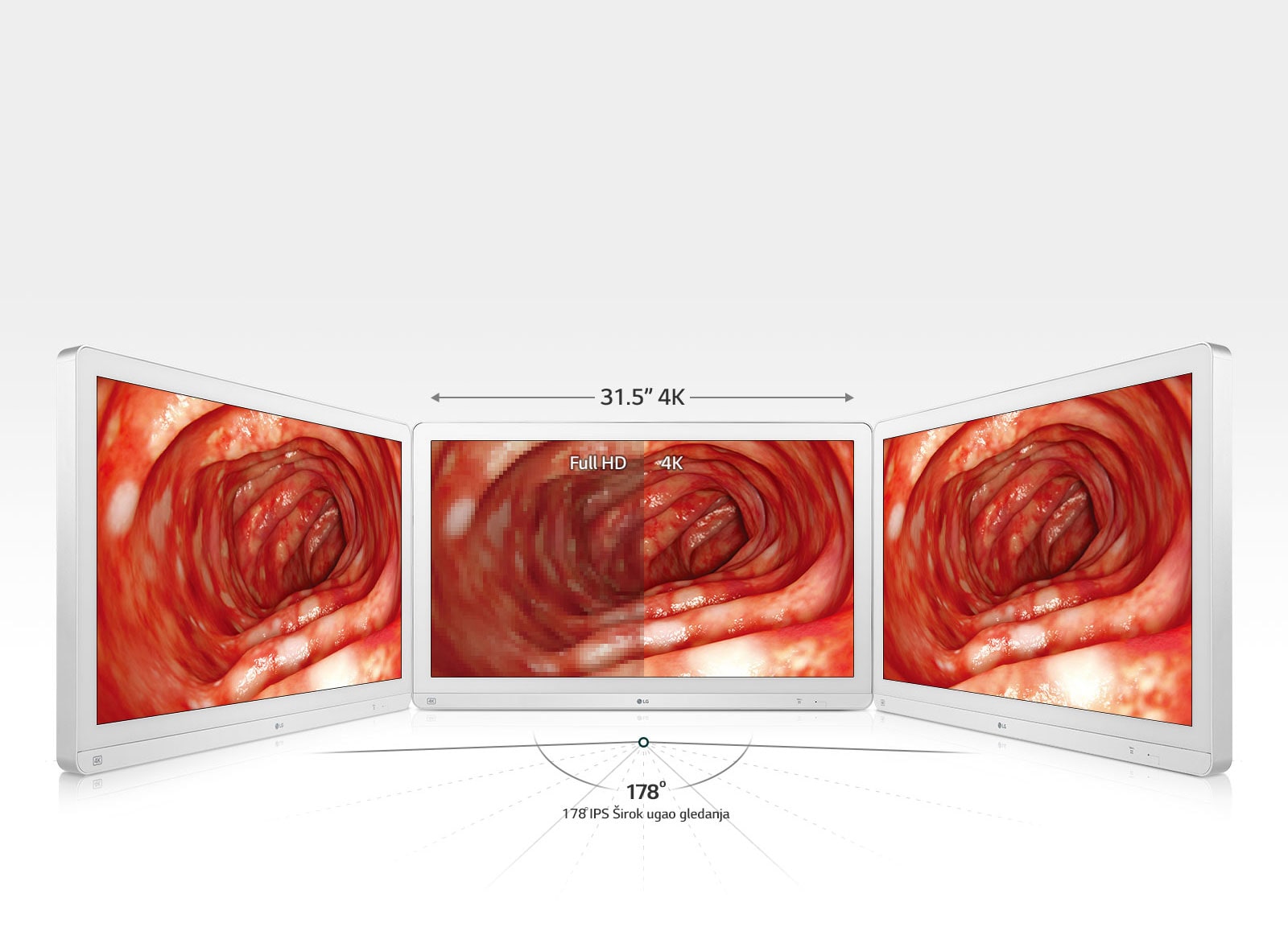 Unapređena Preciznost uz pomoć širokog prikaza1