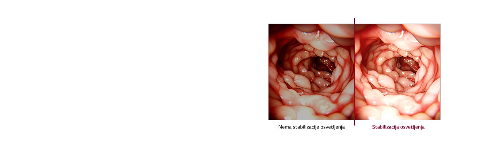 Stabilizacija osvetljenja1