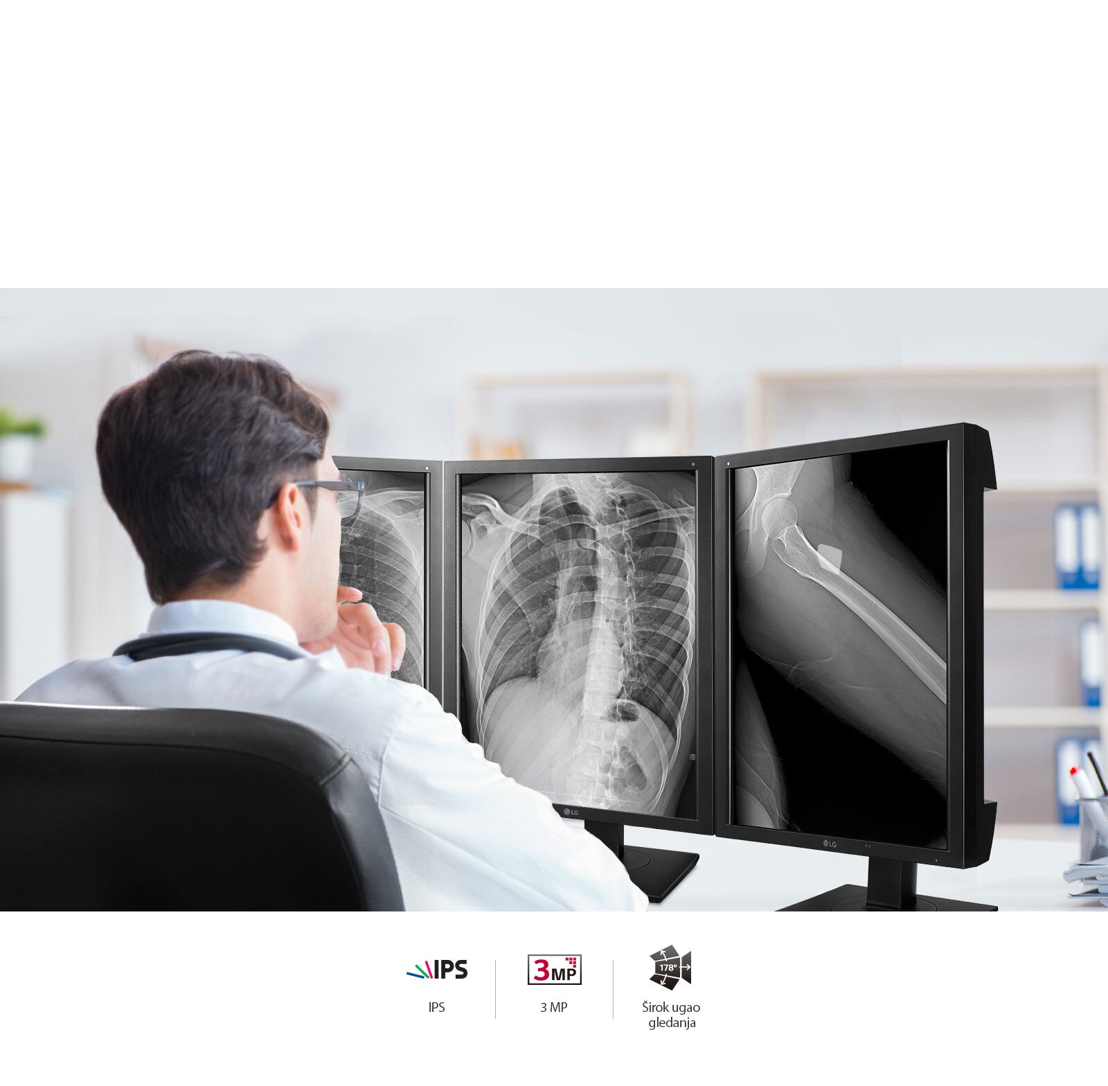 Precizni kvalitet slike1