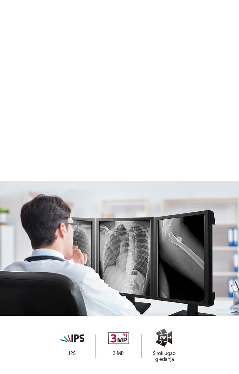 Precizni kvalitet slike2