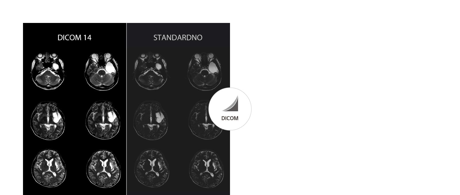 Stabilni snimci u skali sive boje1
