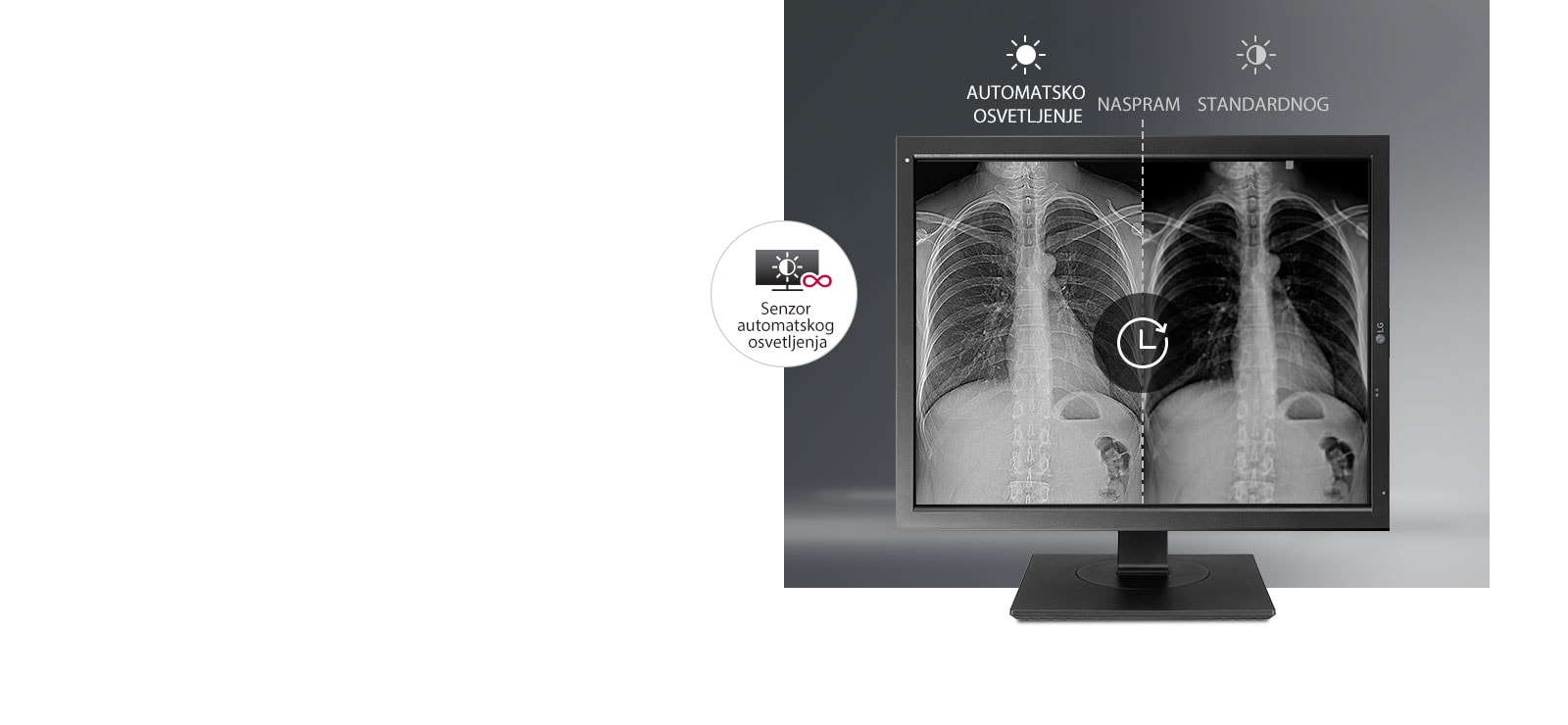 Automatska stabilizacija osvetljenja1