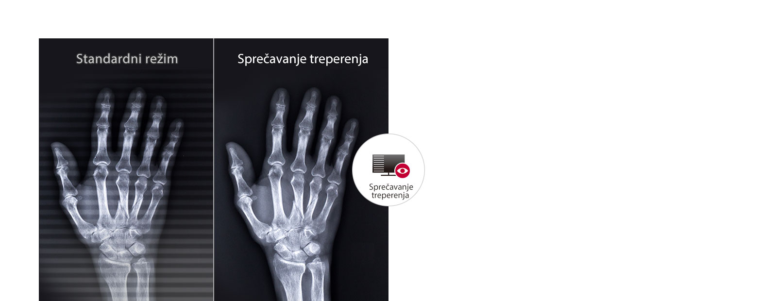 Dugotrajan odmor za oči1