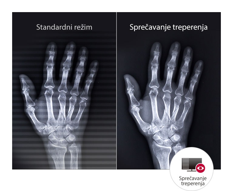 Dugotrajan odmor za oči2