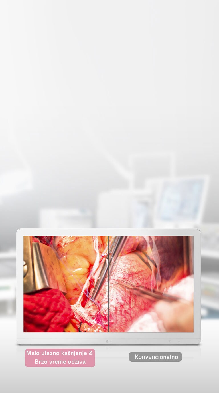 Režim dinamičke sinhronizacije i brzo vreme odziva2