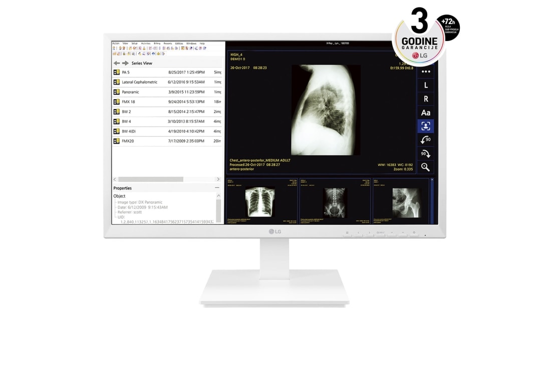 LG 24'' sve-u-jednom Thin Client za zdravstvenu negu, 24CK560N-3A