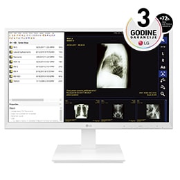 24" sve-u-jednom Thin Client za zdravstvenu negu2