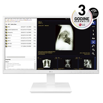 24" sve-u-jednom Thin Client za zdravstvenu negu1