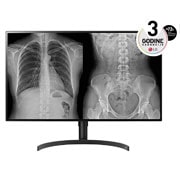 LG 32” 16:9 IPS medicinski monitor 8MP, front view , 32HL512D-M, thumbnail 1