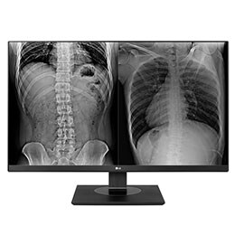 LG 27" 8MP monitor za klinički pregled2
