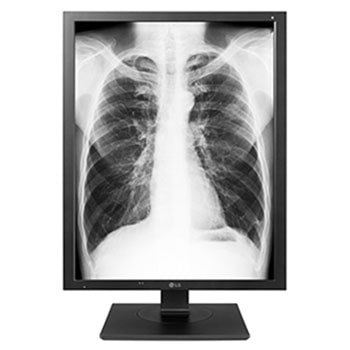 LG 21,3" 3MP dijagnostički monitor1