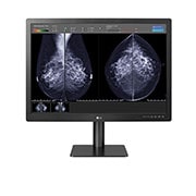 LG Dijagnostički monitor za mamografiju od 31 inča i 12 MP, prikaz spreda sa rezultatima snimanja mamografije koji se prikazuju u softverskom programu na ekranu, 31HN713D-BA, thumbnail 8