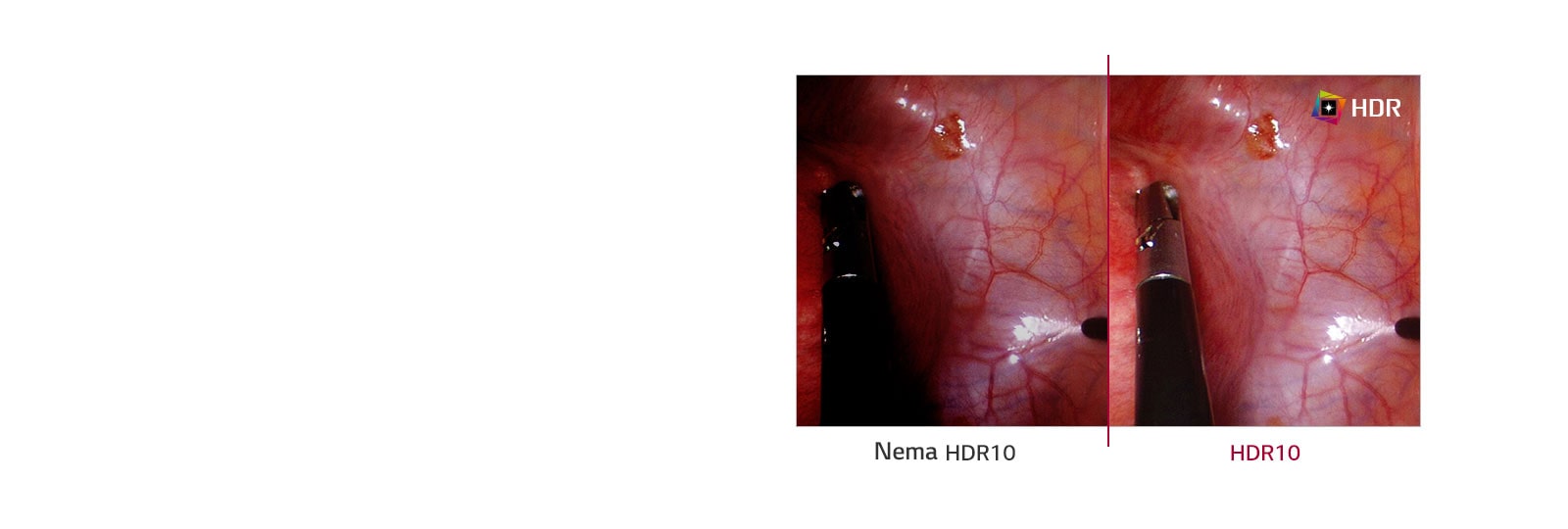 Nema HDR10 naspram HDR10