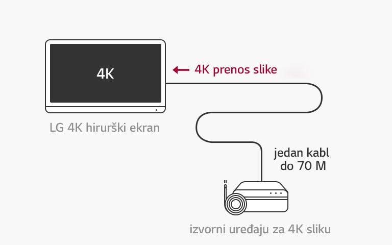 Podrška 12G-SDI: LG 4K hirurški ekran omogućava prenos 4K signala na velike razdaljine preko jednog koaksijalnog kabla bez kašnjenja za stabilan hirurški postupak.