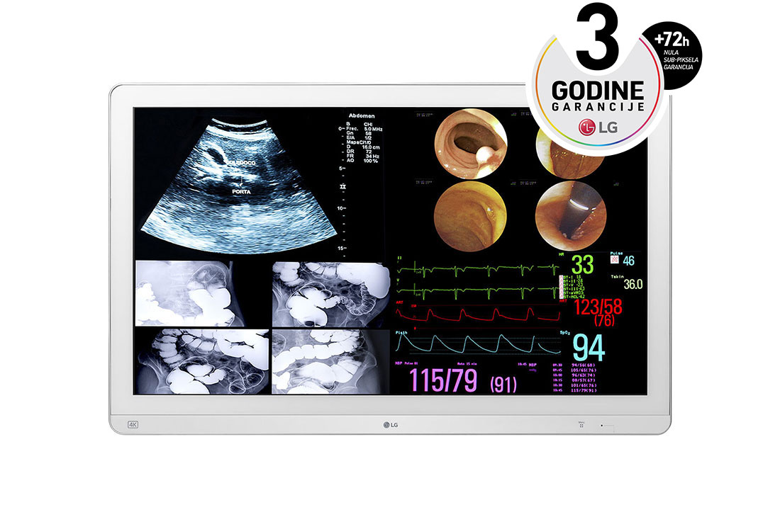 LG 31.5'' 4K IPS hirurški monitor, prikaz spreda, 32HL714S-W