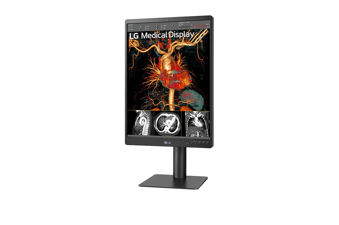 LG 21,3 inča 3MP IPS Dijagnostički monitor, Prikaz sa bočne strane na -15 stepeni, 21HQ513D-B, thumbnail 3