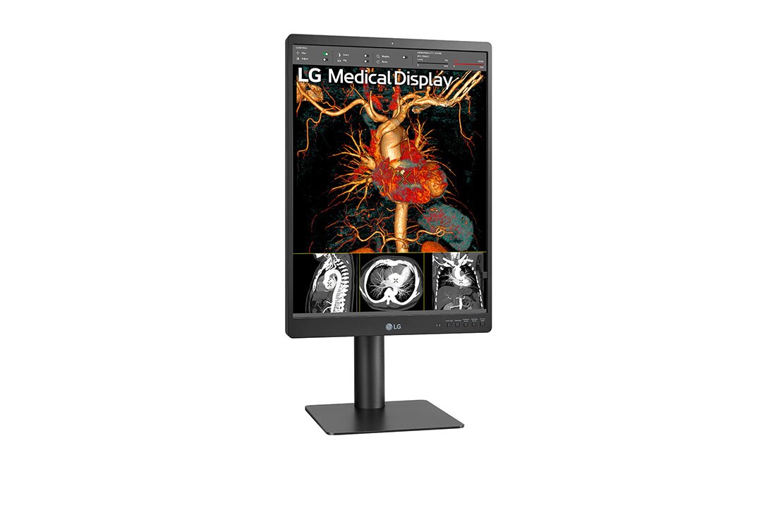 LG 21,3 inča 3MP IPS Dijagnostički monitor, Prikaz sa bočne strane na +15 stepeni, 21HQ513D-B, thumbnail 4