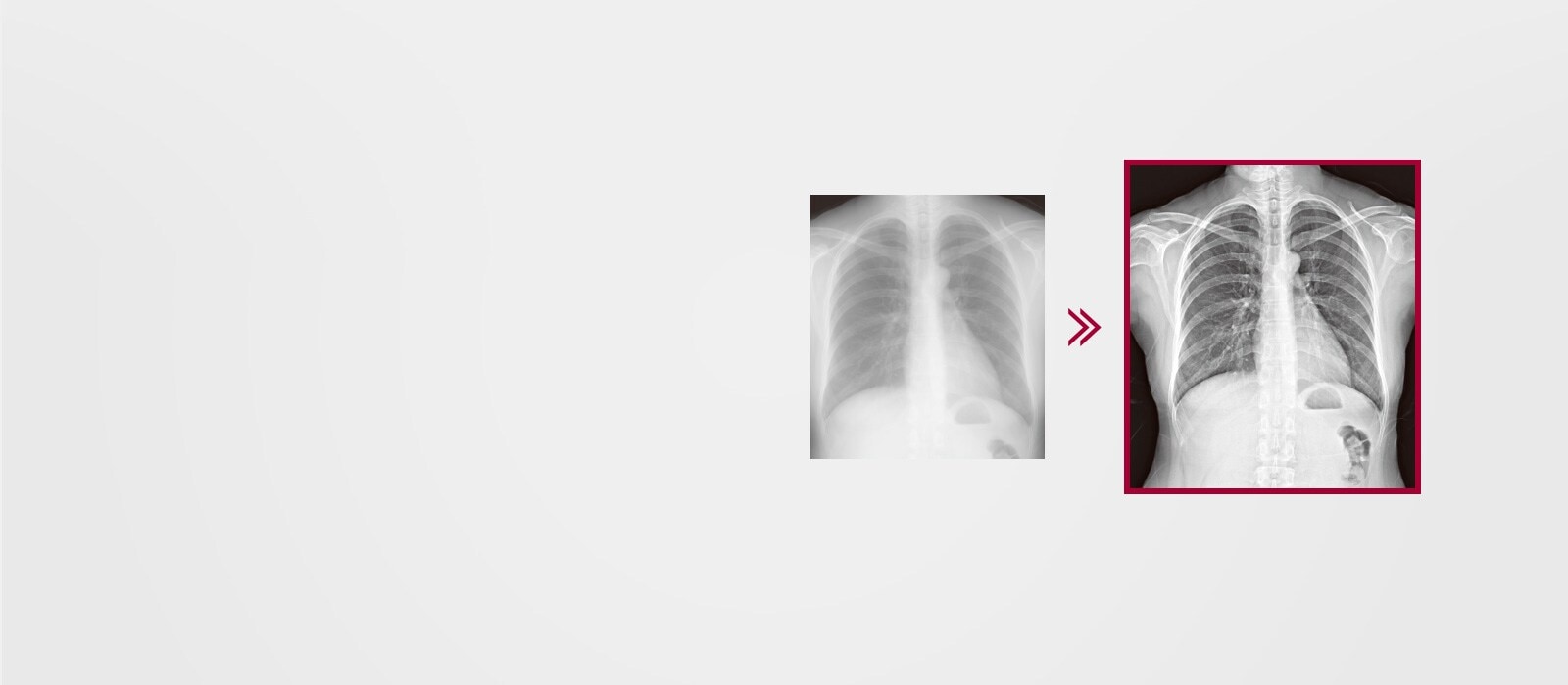 Rezultat slike sa sitnijim detaljima pomoću funkcije višeslojne obrade slike koja je ugrađena u AWS, u poređenju sa rezultatom slike bez funkcije višeslojne obrade slike