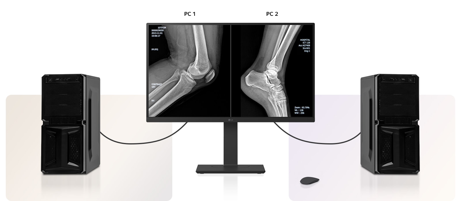 Slika koja prikazuje dva računara povezana na jedan monitor koji koriste dvostruki kontroler i KVM prekidač radi lakog obavljanja više zadataka istovremeno.
