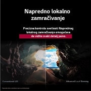 LG 65-inčni LG NanoCell AI NANO90 4K pametni televizor 2025, Advanced local dimming, 65NANO90A3B, thumbnail 8
