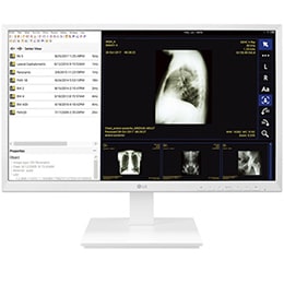 Тонкий клиент LG 24CK560N-3A для медицинских учреждений2