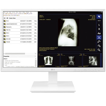 Тонкий клиент LG 24CK560N-3A для медицинских учреждений1