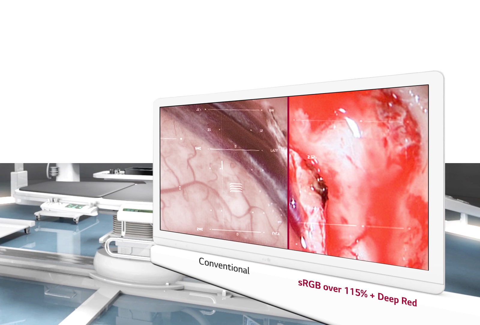 LG LG Full HD Surgical Monitor LG US