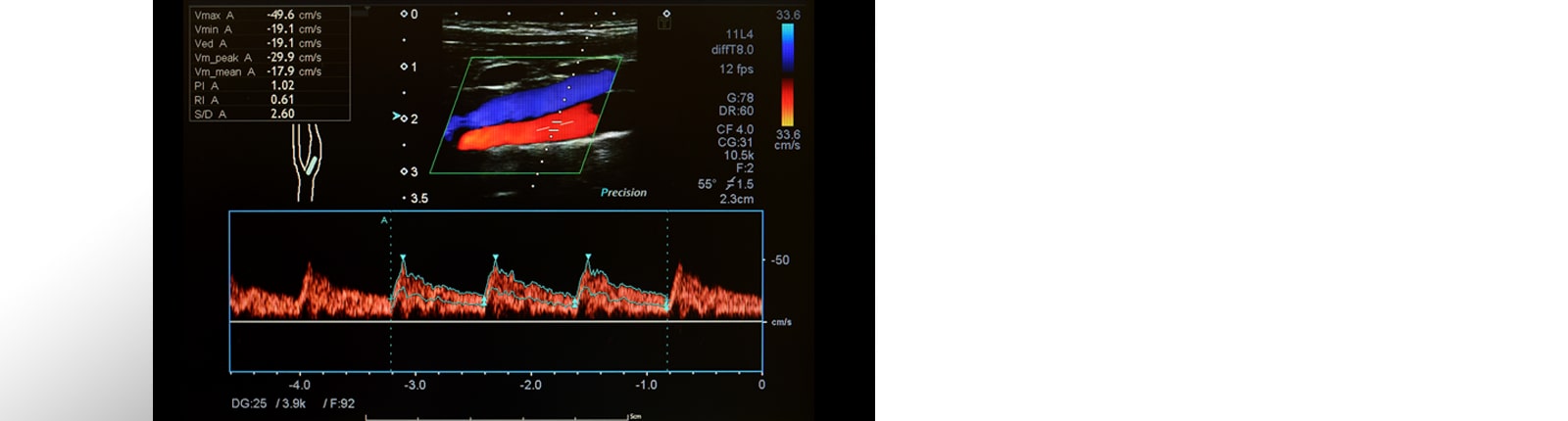 31” 12MP IPS Diagnostic Monitor for Mammography with pathology mode